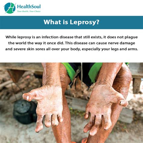 leprosy definition